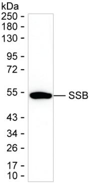 SSB